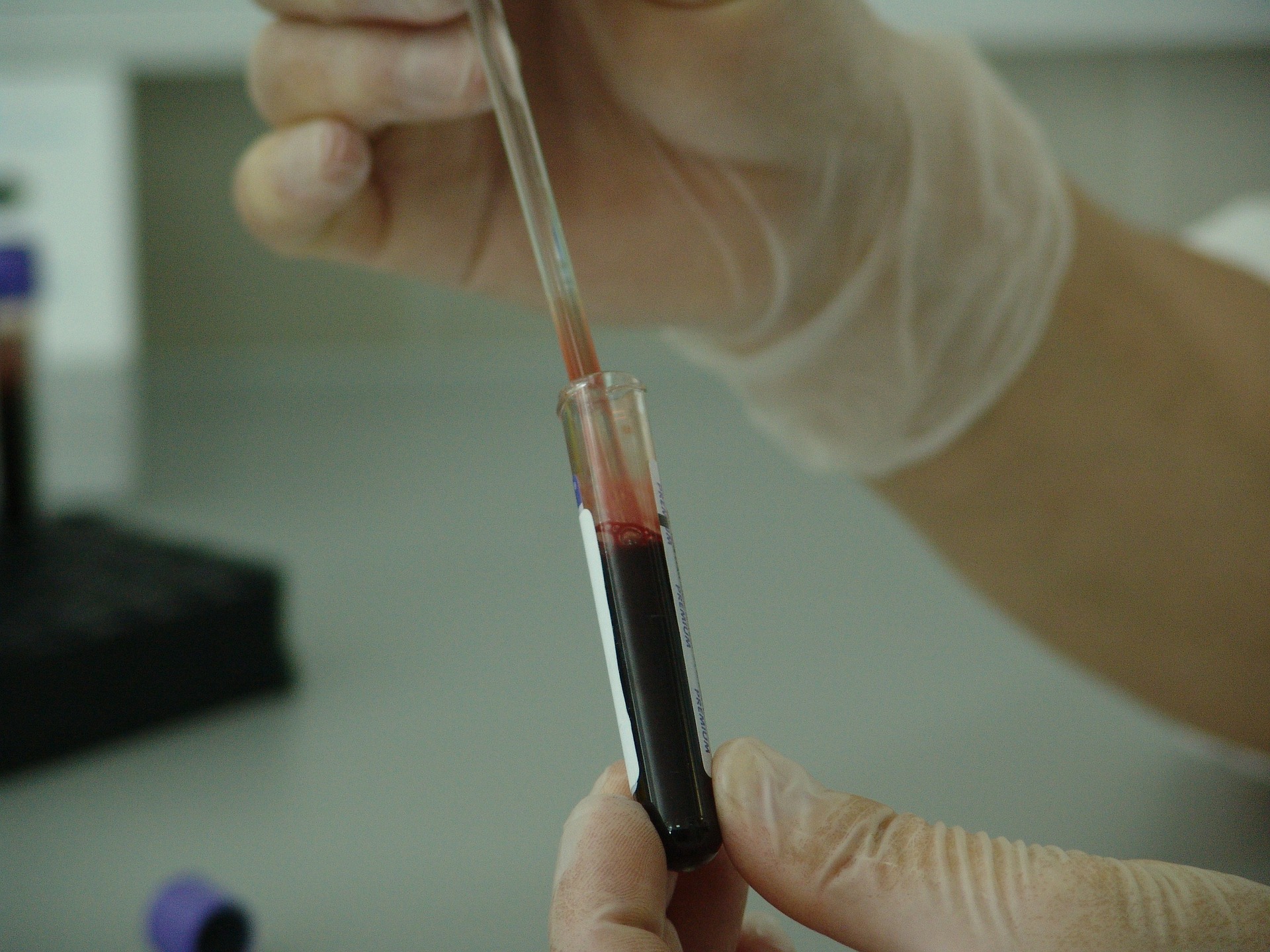 blood-20745_1920
